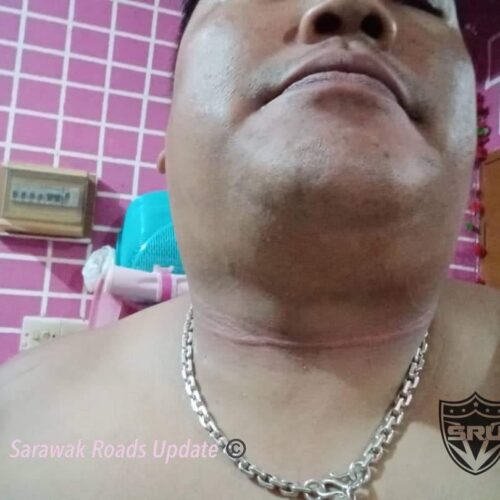 Penunggang Motosikal Cedera Pada Bahagian Leher Kerana Tali Layang – Layang di Jalan Tol Kuching.
